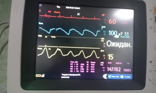 Перевозка с Областной больницы г. РЯЗАНИ больного 76 лет с переломом шейки бедра нашим реанимобилем в стационар г. Москвы.