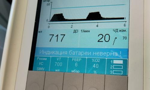 Консультация нашим нейрореаниматологом в црб г. КОВРОВ (Владимирской области) больной 46 лет с геморрагическим инсультом для организации госпитализации в профильный московский стационар.